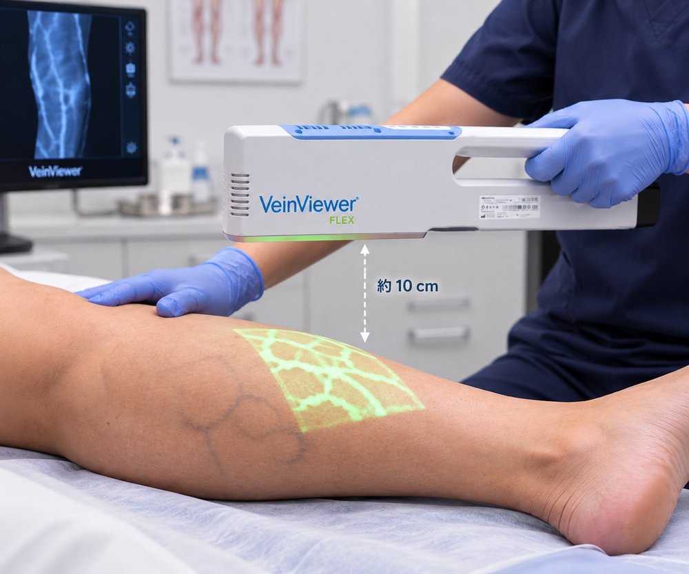 醫護人員手持靜脈顯像儀（VeinViewer FLEX），在距離腿部約10公分處以綠色光學投影顯示小腿皮下靜脈走向，旁邊螢幕同步呈現靜脈影像。